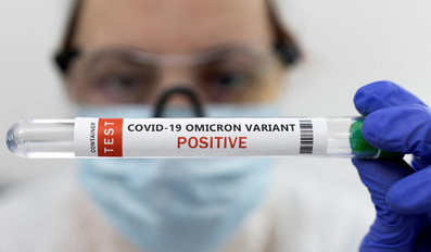 COVID-19 Omicron variant test 